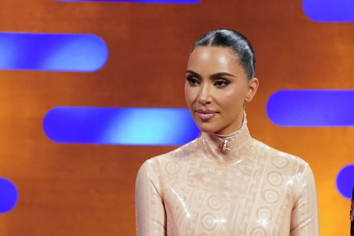 Kim Kardashiannál agyi aneurizmát diagnosztizáltak