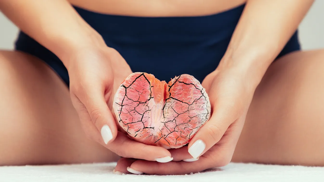 Hüvelyszárazság – amikor a női komfortérzet csorbát szenved