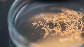 Parazita tisztítókúra: valóban működik, vagy átverés?