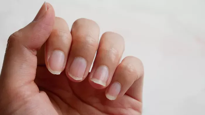 Tünetek, amik vitaminhiányra utalhatnak – Ezekre figyelj oda