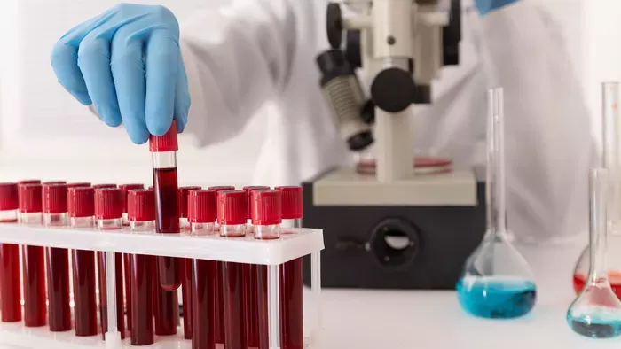 Arany vércsoport, amivel mindössze 50 ember rendelkezik