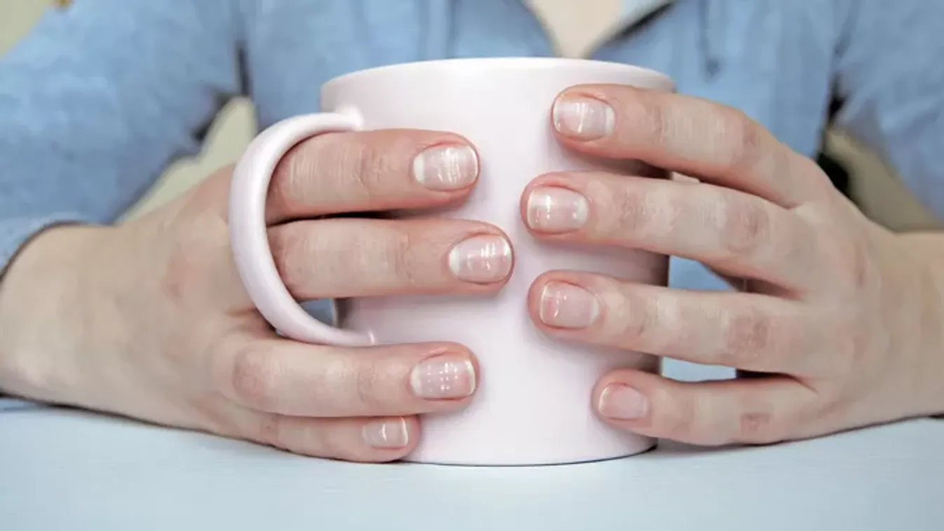 Kalciumhiány: így jelez a tested, hogy baj van – Ne hagyd figyelmen kívül