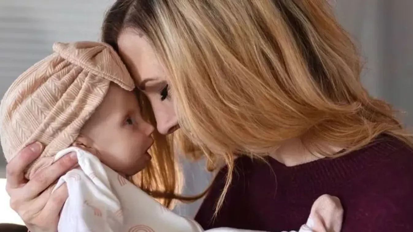 "Gyakorlatilag felajánlották a gyászcsomagot" – már születése előtt temették a dokik a ritka betegségben szenvedő kislányt