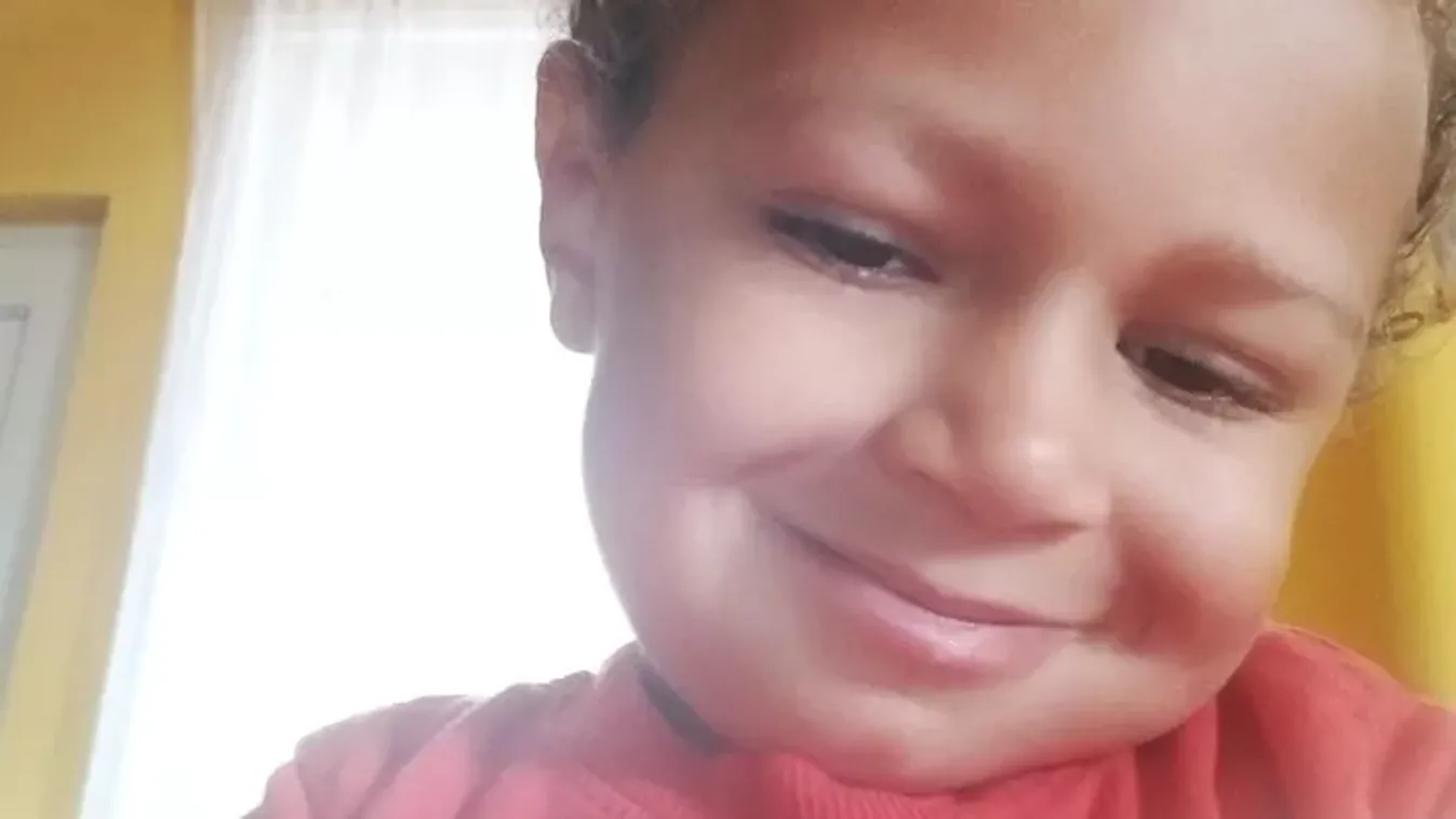 Újabb fájdalmas műtét vár a dongalábú kis Noelre