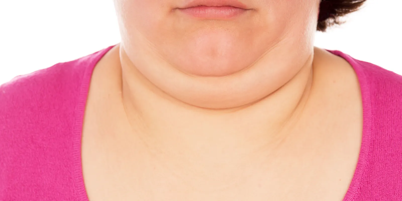 Karcsúsító divattippek a toka eltüntetéséhez