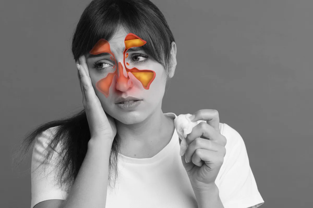 Arcüregtisztítás arcüreggyulladás miatt