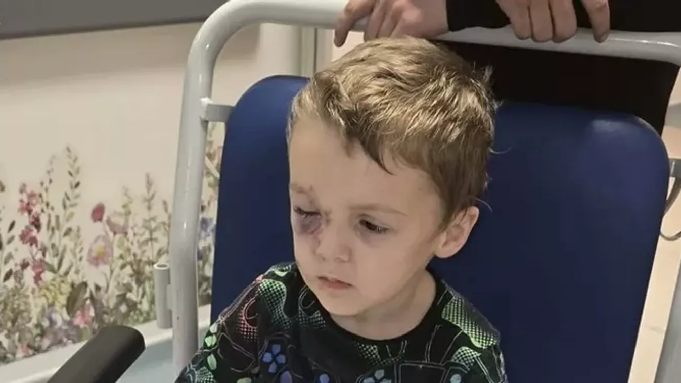 Csak az iskolából akartak hazamenni: brutális kutyatámadás áldozata lett egy autista kisfiú