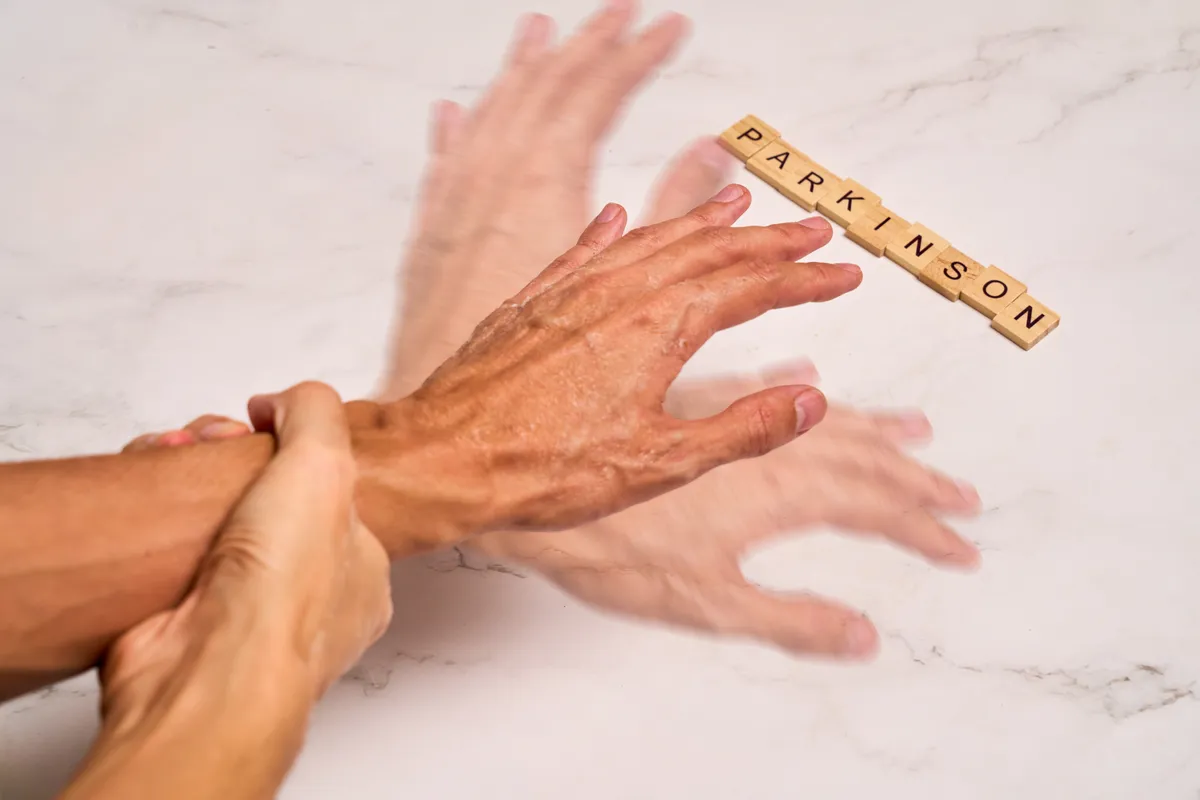 Remegés mint a Parkinson-kór egy jellegzetes tünete