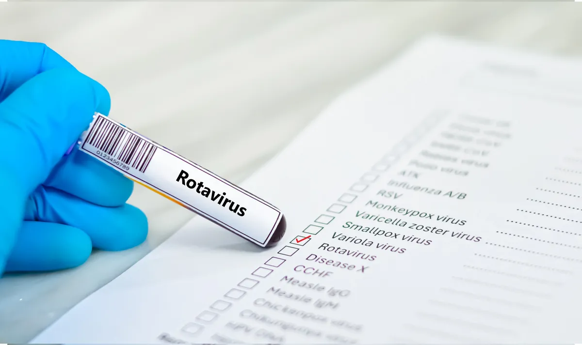 Rotavírus kimutatása