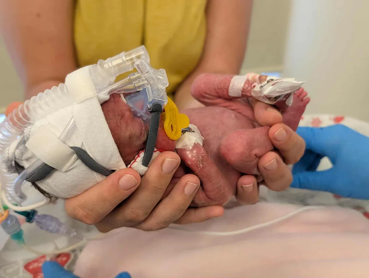 A koraszülött baba, Alexa három hetes korában édesanyja kezében.