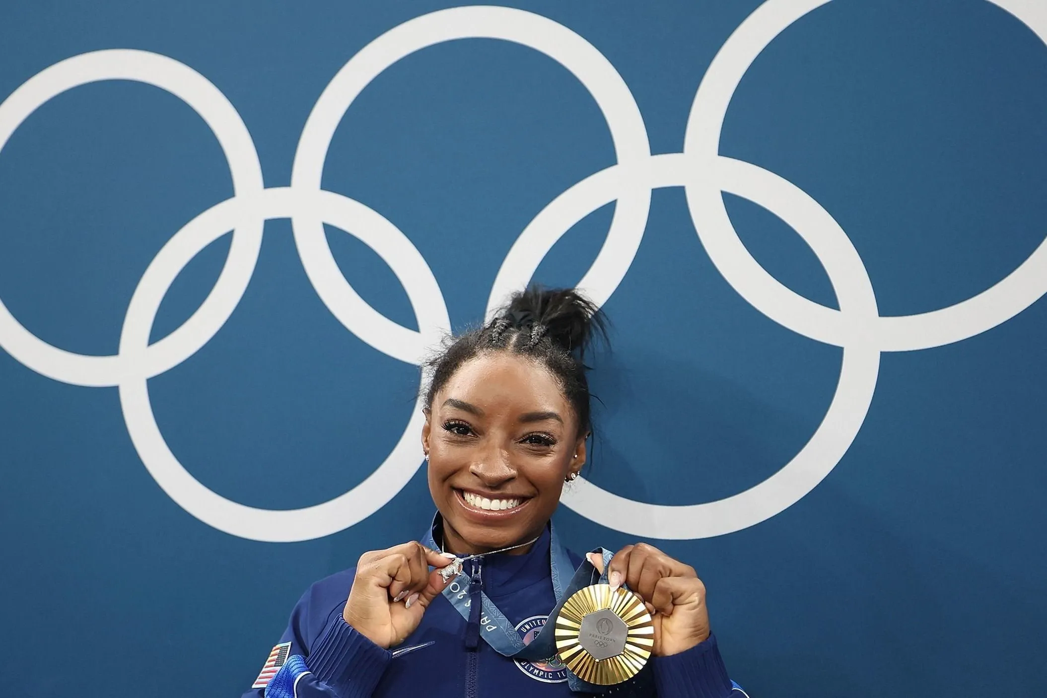 Simone Biles bevallotta az összes plasztikai műtétjét