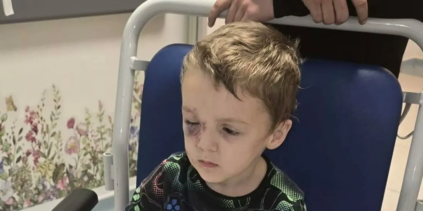 Csak haza akart menni: kutya támadt az autista kisfiúra