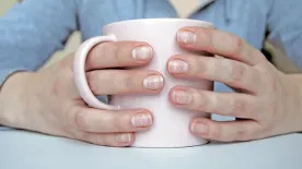 Kalciumhiány: így jelez a tested, hogy baj van – Ne hagyd figyelmen kívül