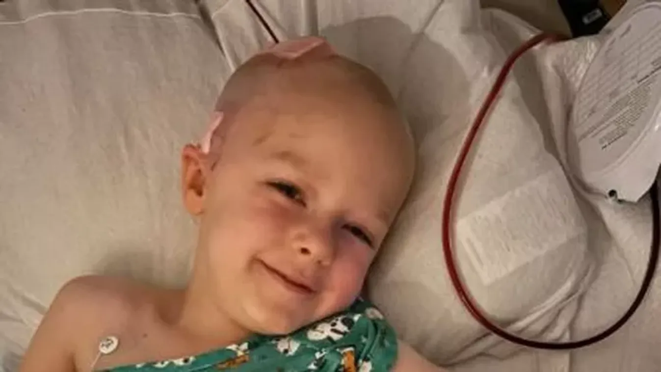 Darabokra tört a csodás kisfiú koponyája: egészen hihetetlen, ahogy túlélte