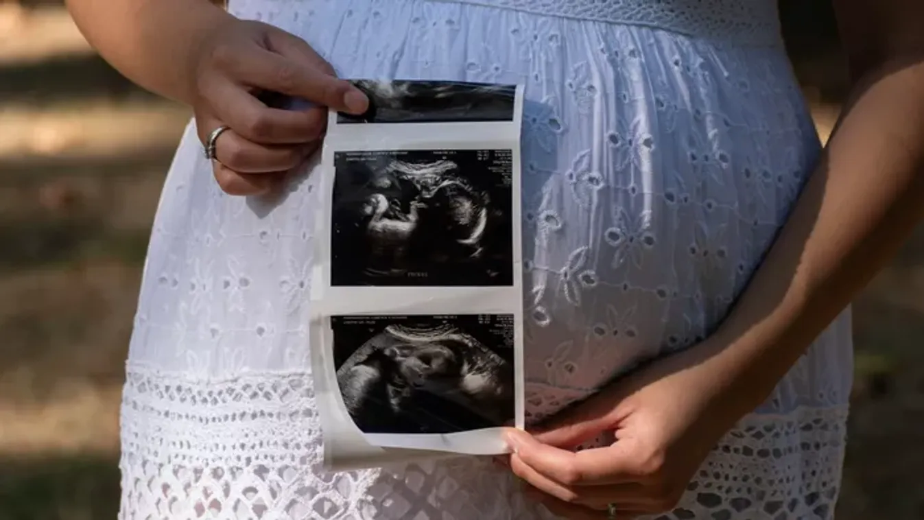 Máris babát vár a Házasság első látásra sztárja – így közölte az örömhírt a szőke szépség