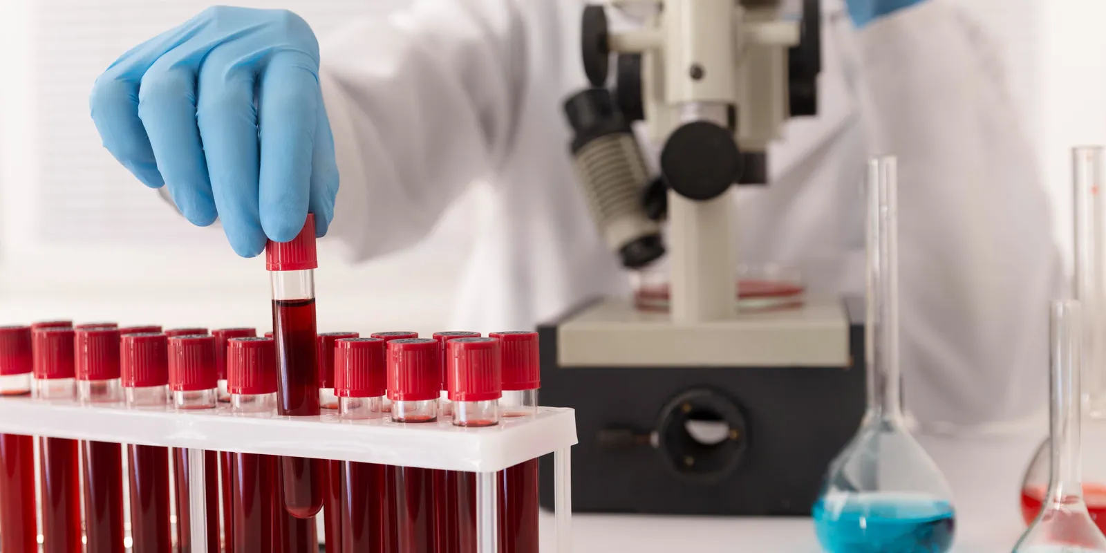 Arany vércsoport, amivel mindössze 50 ember rendelkezik