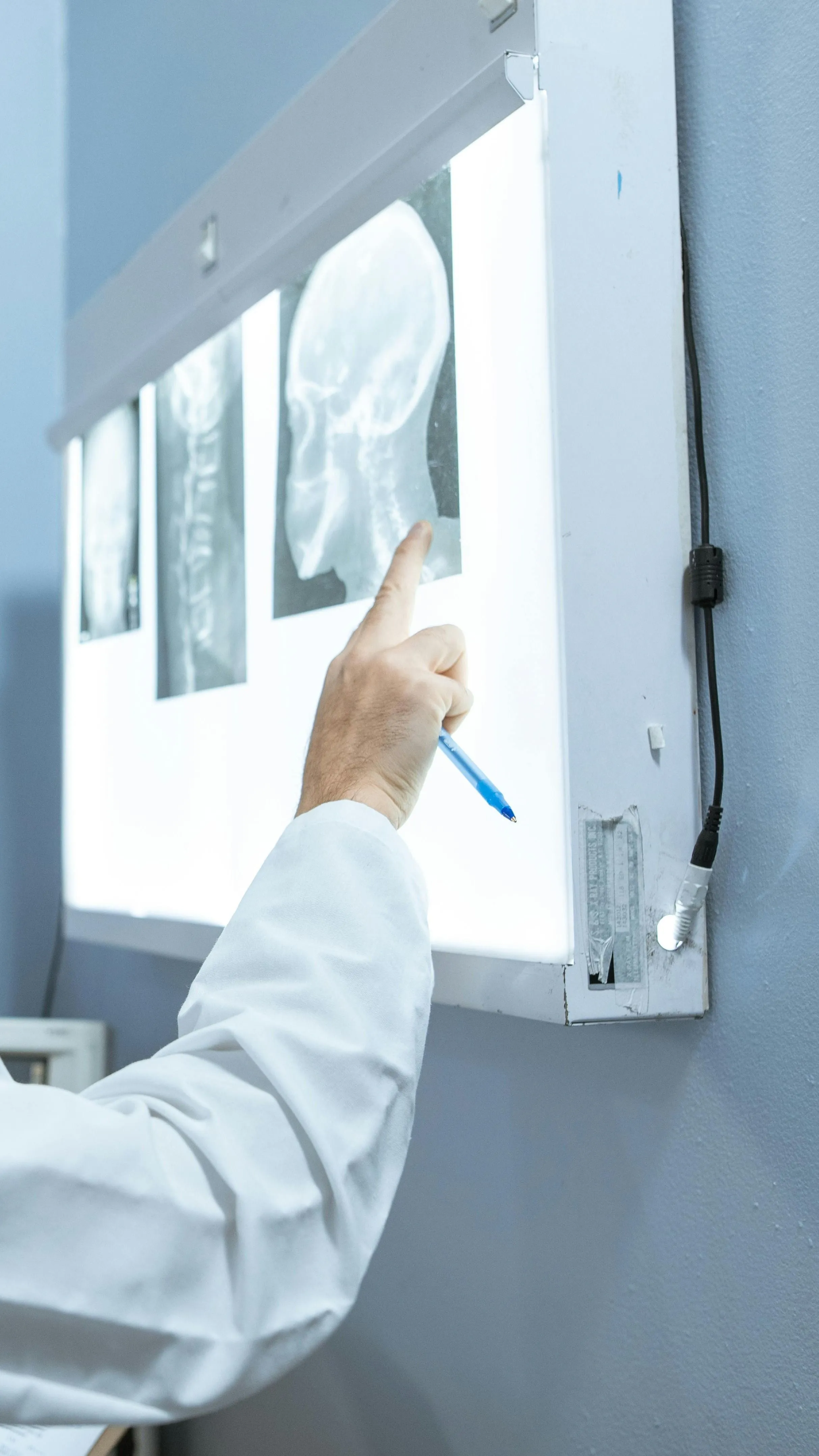 A veséjét vizsgálták, golyót találtak a koponyájában