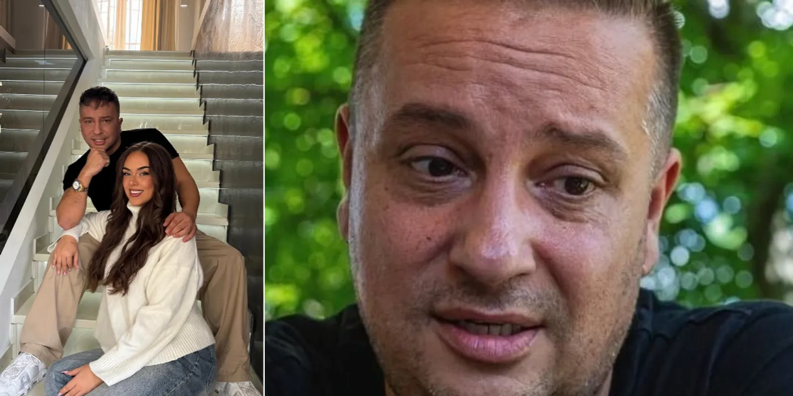 Gyanakodnak a netezők: L.L. Junior plasztikai sebésznél járt?