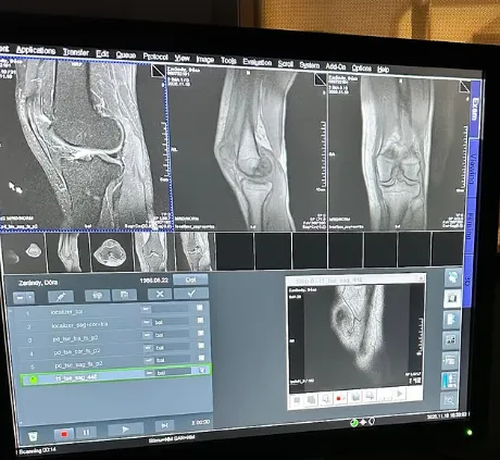 Debreczeni Dóra súlyos sérülést szenvedett