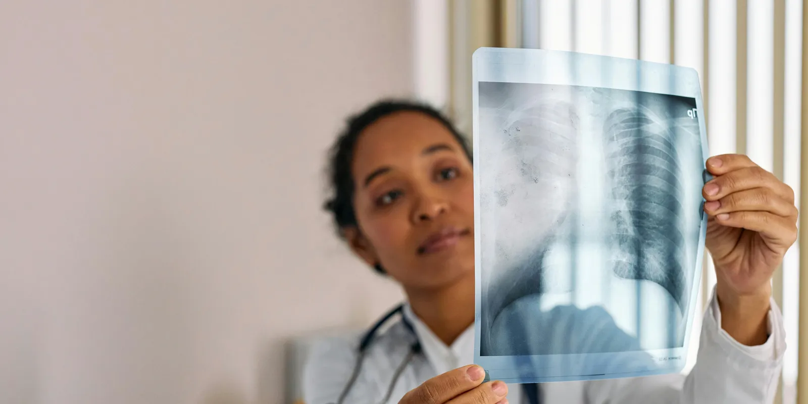 Rákdiagnózisánál is rémisztőbb hírt kapott műtétje után a nő