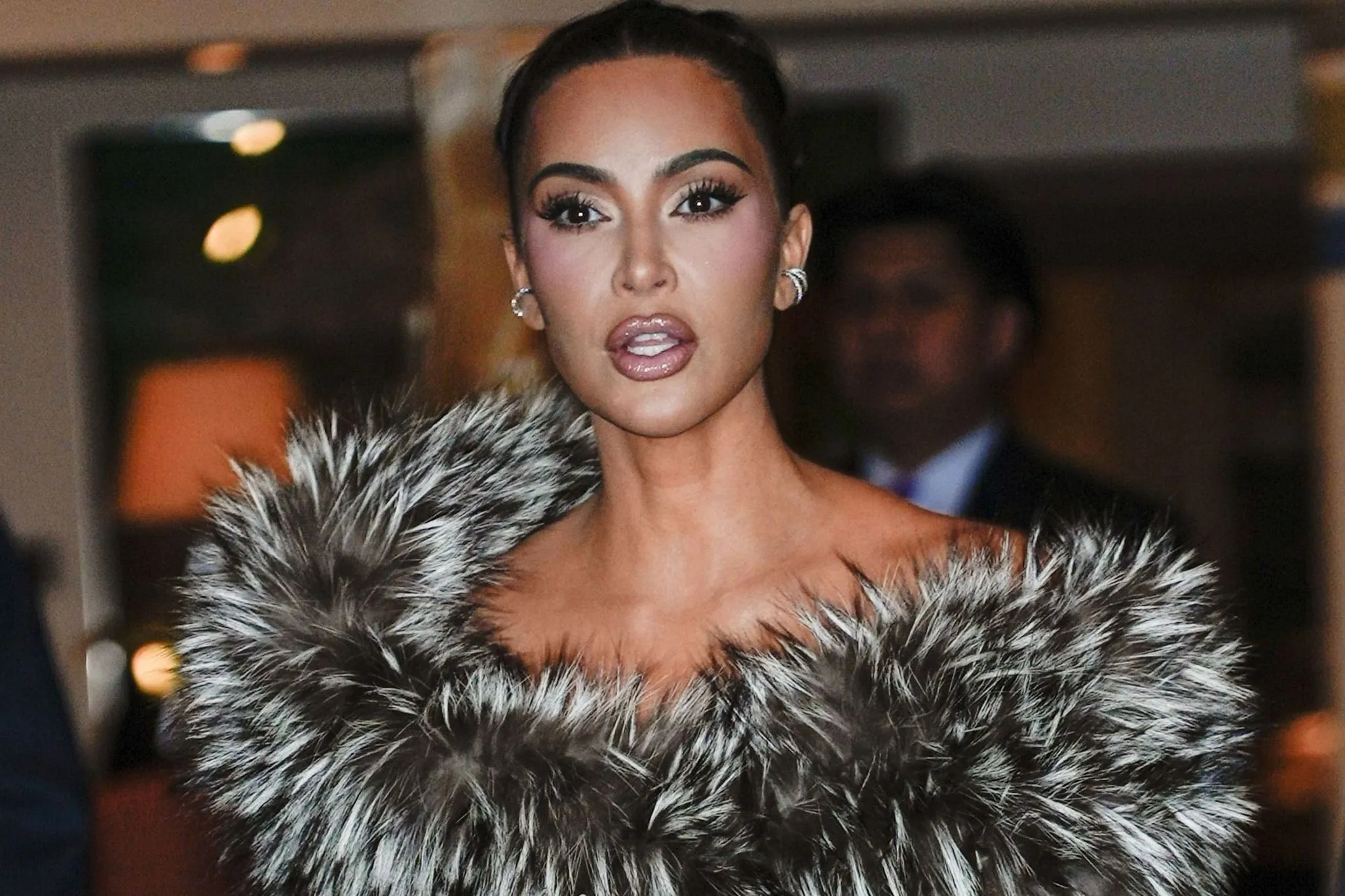 Figyelmeztették az orvosok Kim Kardashiant betegsége miatt