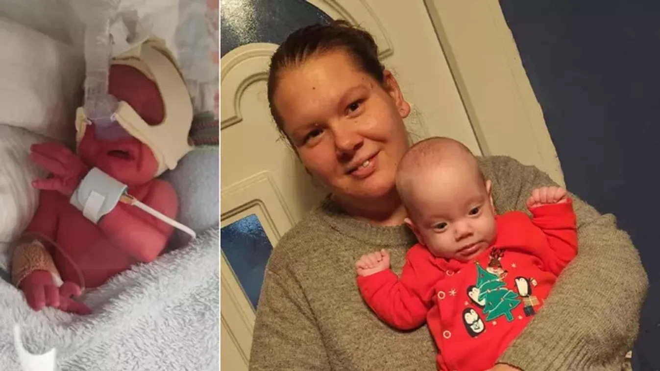 „Először egy fényképen láthattam Lilit” – az anyai ösztön mentette meg a koraszülött gyermeket