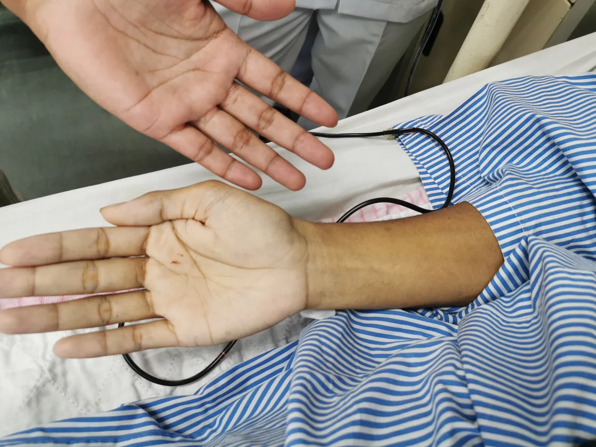 Halál jelei egy haldokló kezén