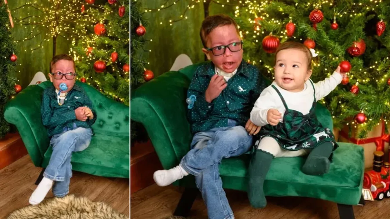 „Attól félek, hogy egyszer felkelek és már nincs velünk” – Halálos epilepsziával küzd a kis Ábel