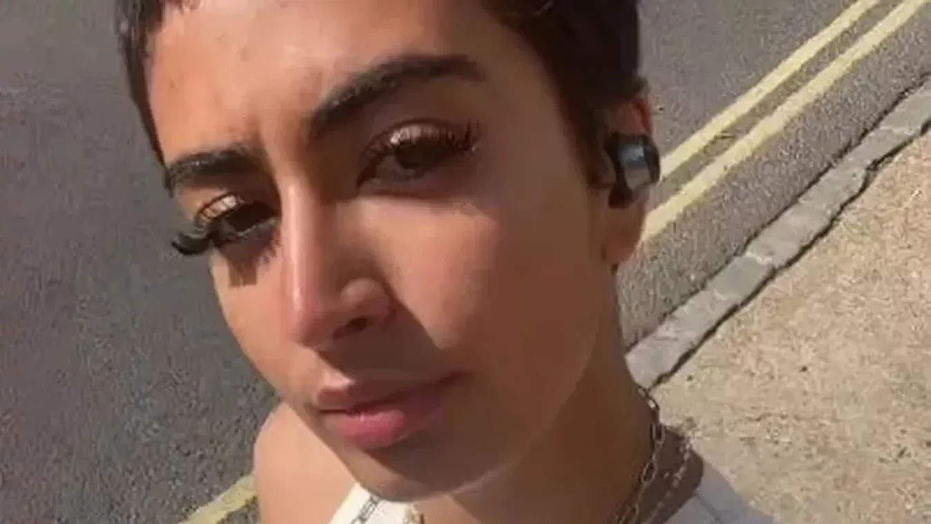 "Az emberek undorítónak találják a szőrős lábam és a hónaljam, de én imádom a szőrös testem"