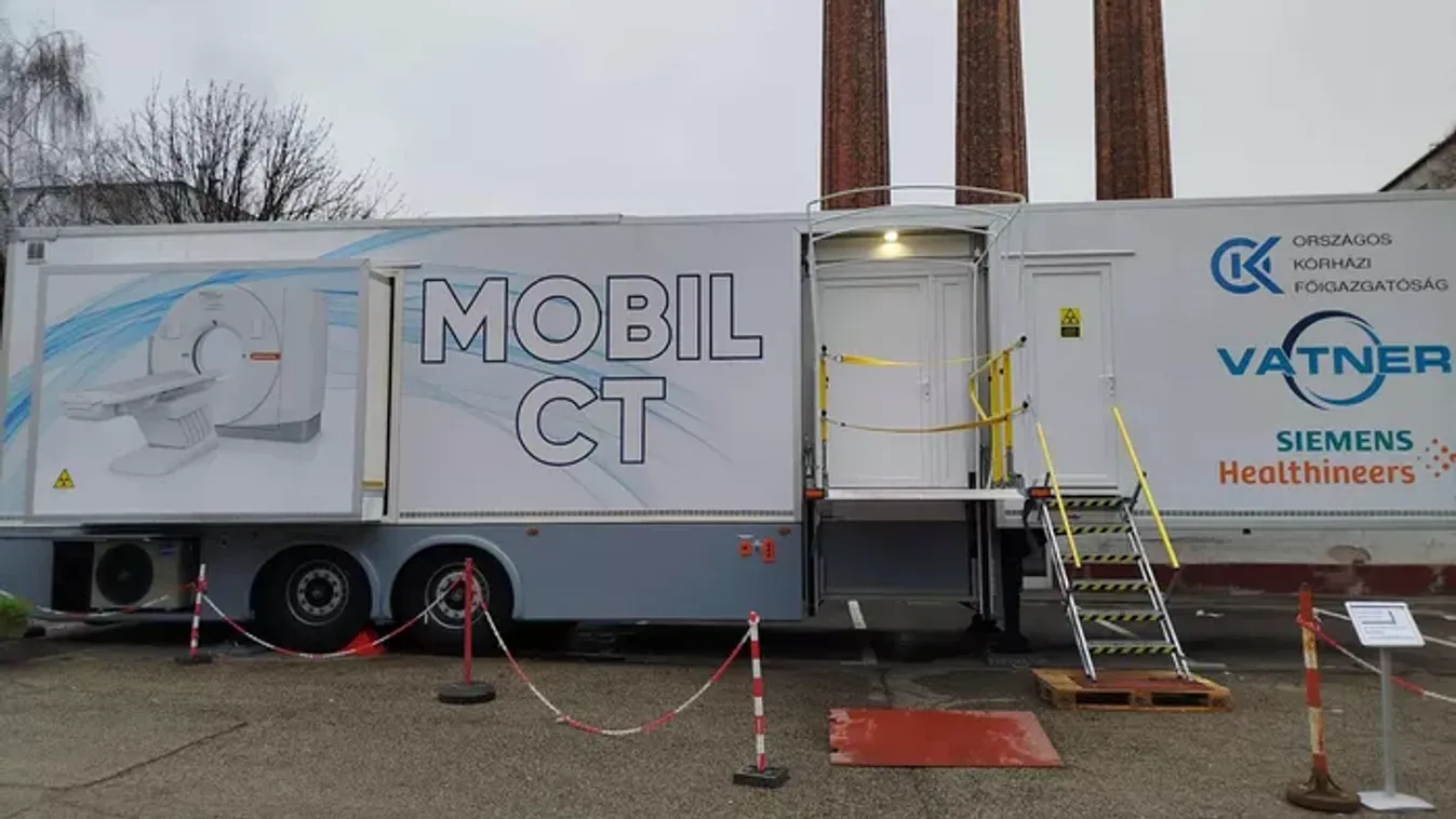 Ultramodern, AI alapú mobil CT-vel vizsgálják a betegeket a Budapesti Bajcsy-Zsilinszky Kórházban