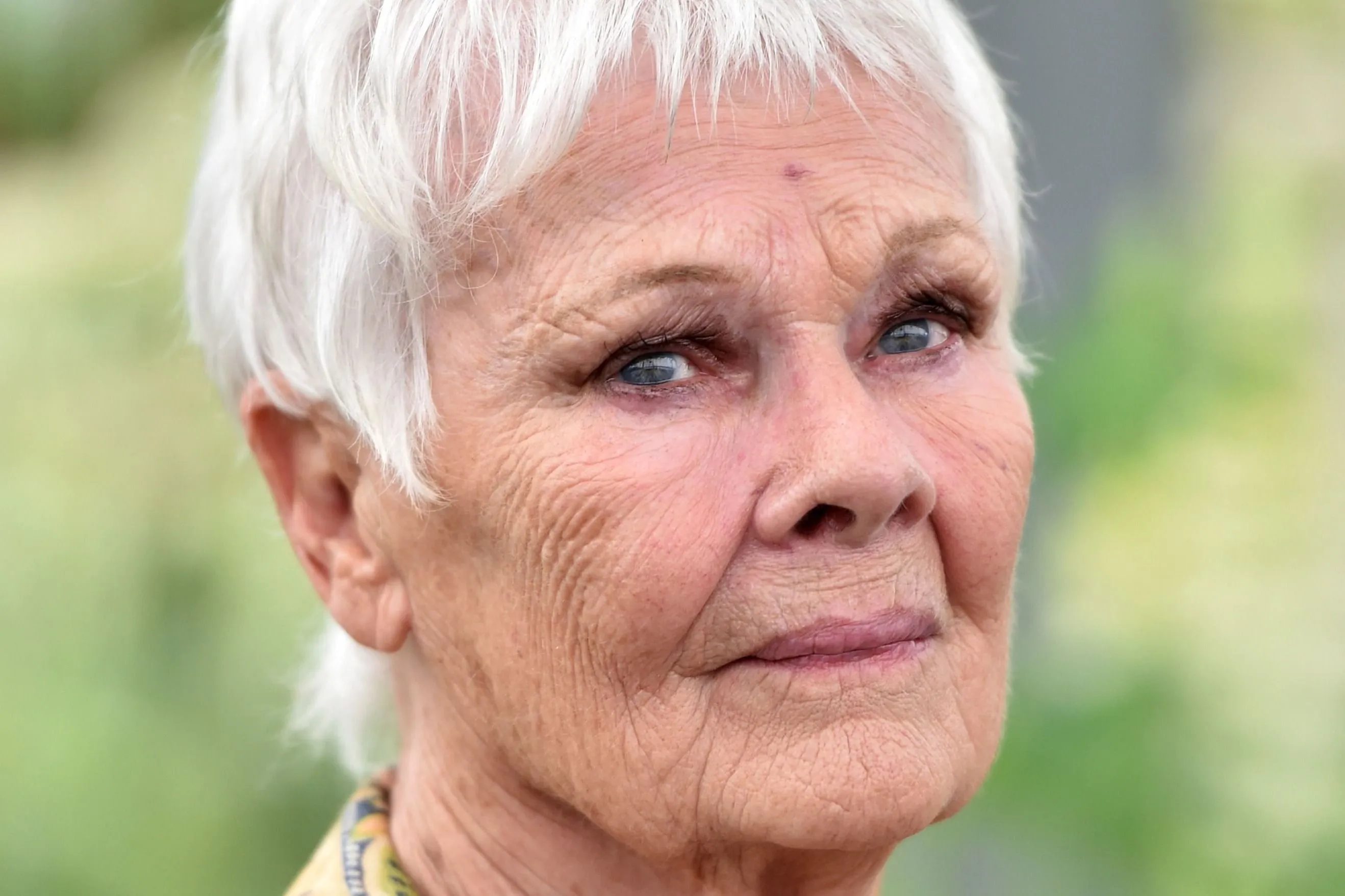 Judi Dench szinte teljesen megvakult, állandó segítségre van szüksége