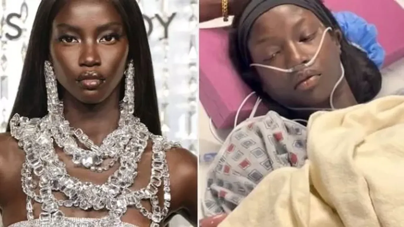 Lesújtó diagnózist kapott a gyönyörű modell, azonnal műteni kellett