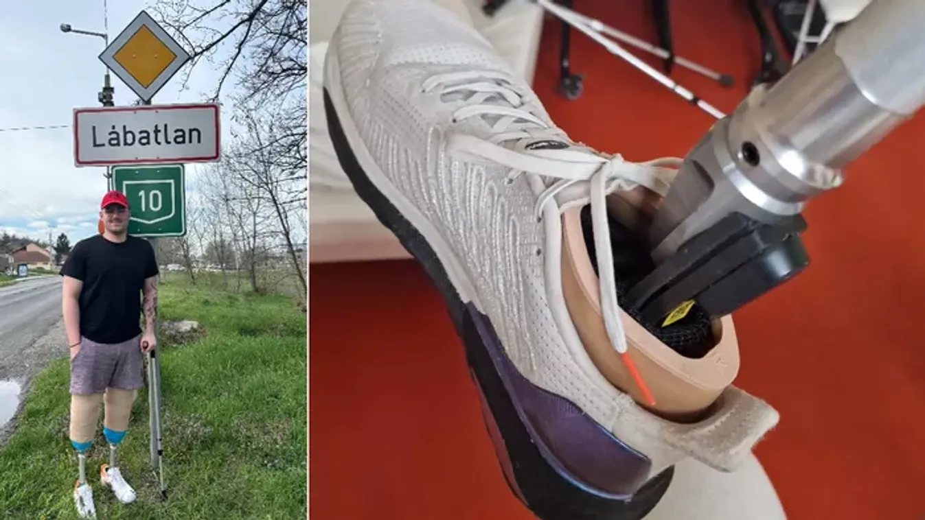 Négy hétig feküdt kómában, és mindkét lábát elveszítette, mégsem adja fel Ákos: "Minden reggel mosollyal ébredek"