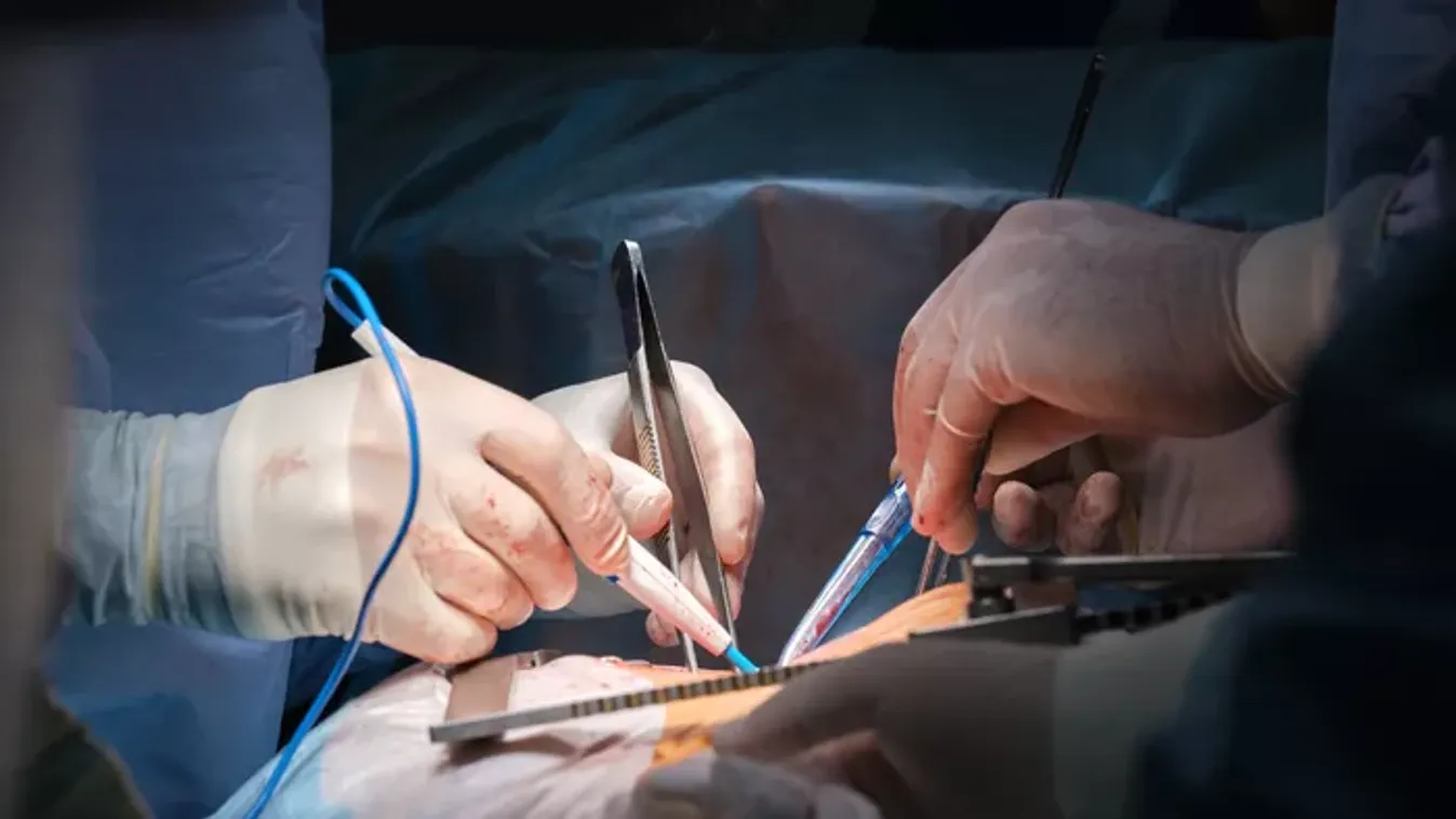 Aggódnak a színésznőért: a roham után agyműtéten esik át a híresség