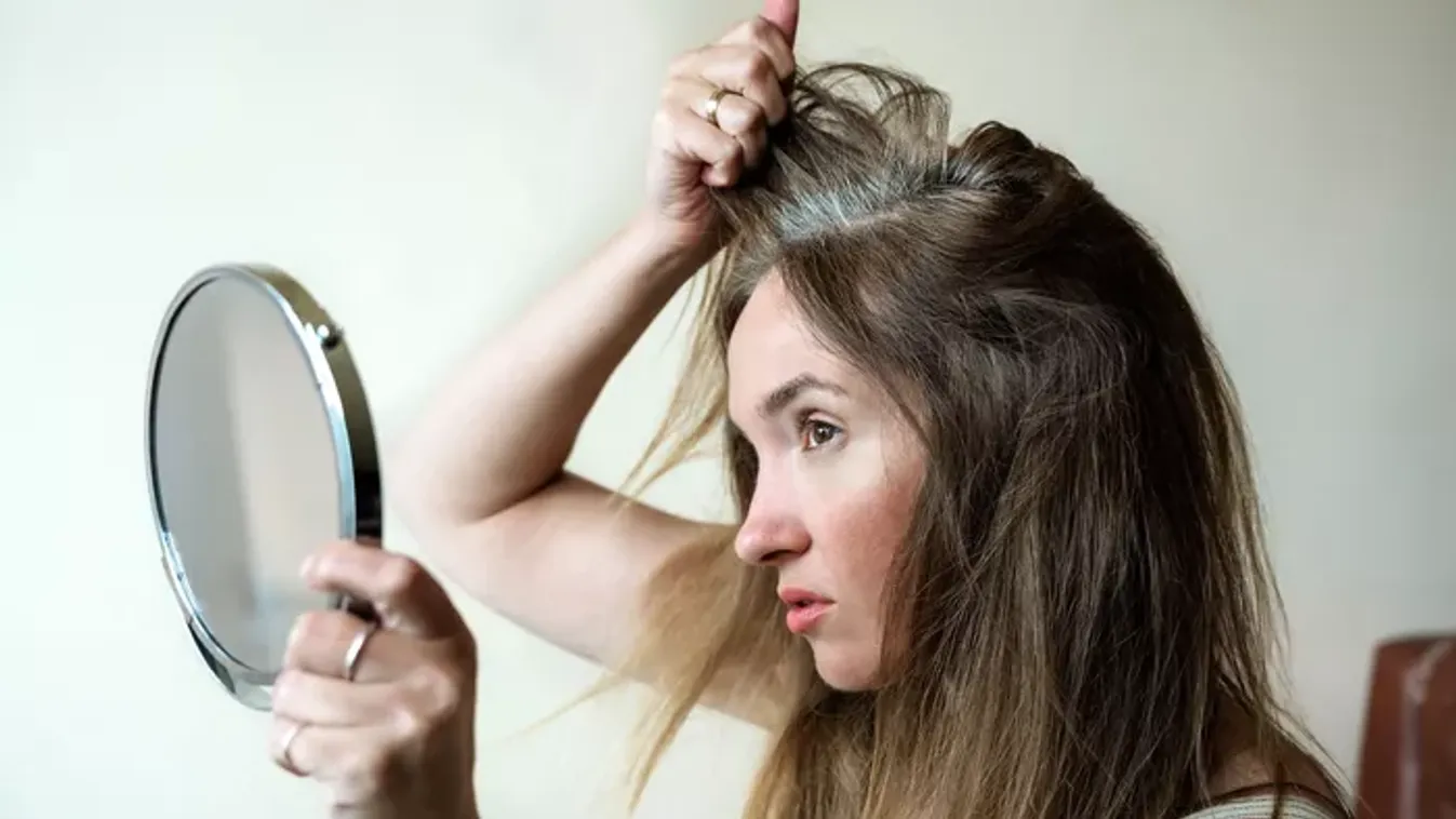 Hogyan előzhető meg az ősz haj? Tippek, amik tényleg segíthetnek