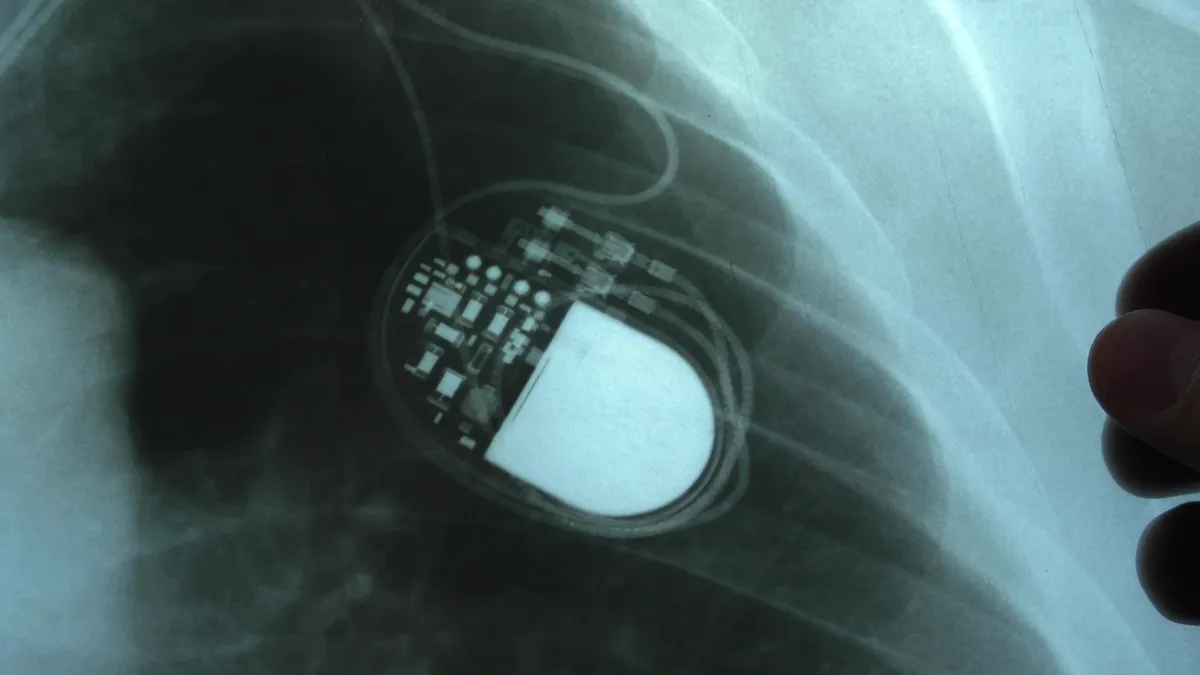 Beültetett pacemaker