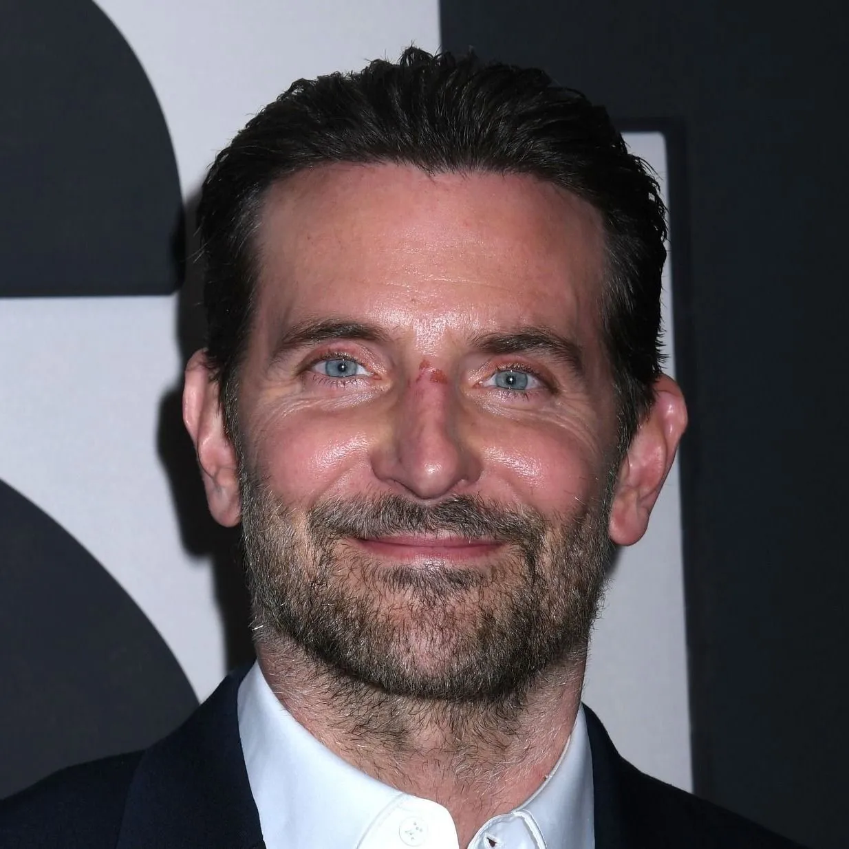 Bradley Cooper eddig bírta! Végre megszólalt arcfelvarrása kapcsán