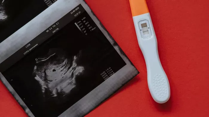 Hosszú küzdelem után kisbabát vár Sodró Eliza