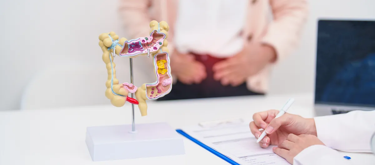 Crohn-betegséget illusztráló orvosi bél makett