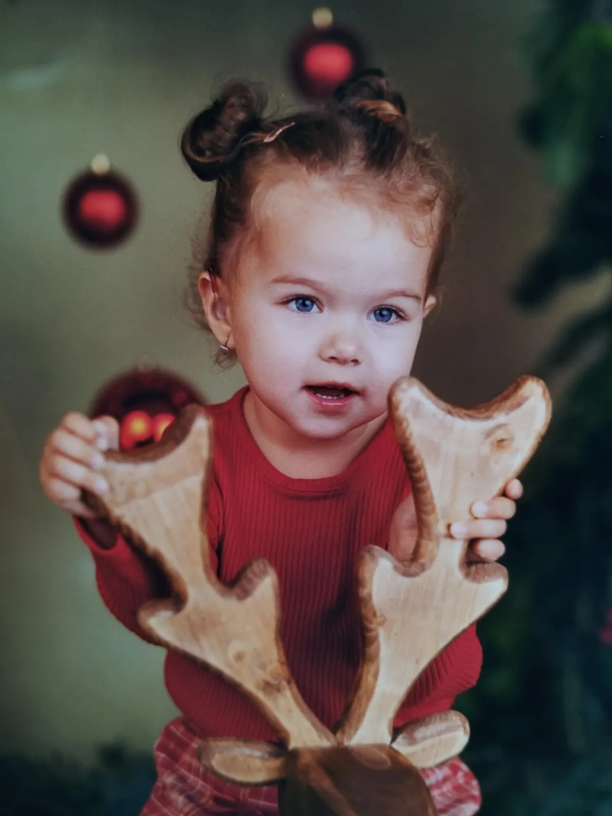 Aletta bilirubin szintje 5 napos korában az egekbe szökött