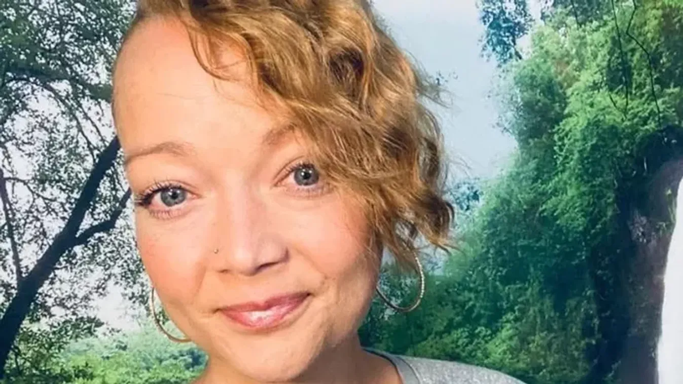 Brutális kutyatámadás: Saját kutyája támadta meg az édesanyát, amputálni kellett a lábát