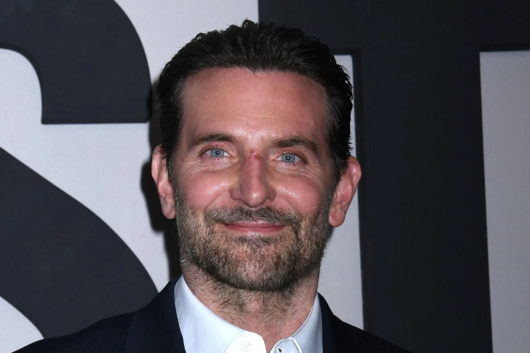 Bradley Cooper plasztikai beavatkozásáról vallott