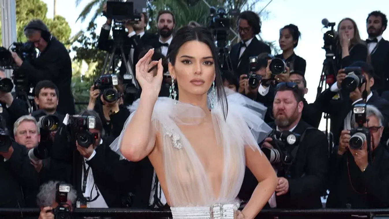 Sztárok a kés alatt: kik és miért plasztikáztattak