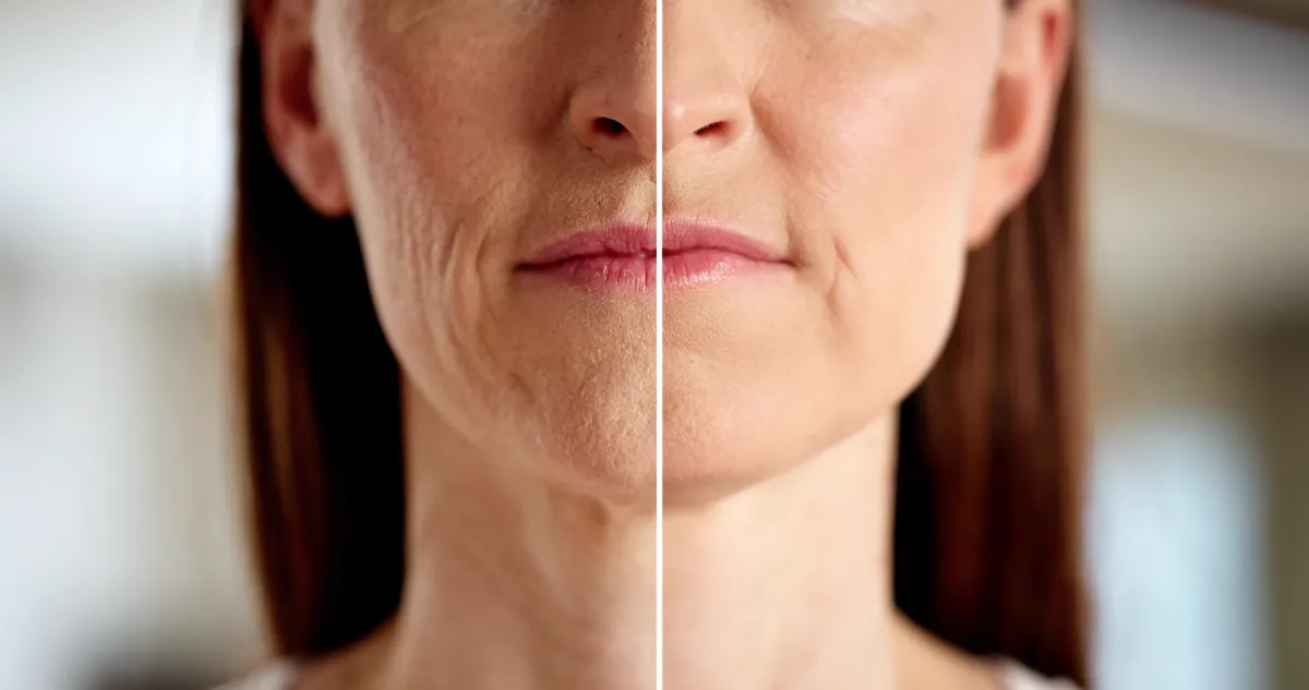 Ráncos bőrű nő álla közelről.