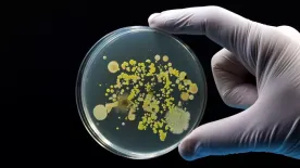 A 21 éves nő fájdalomra panaszkodott – húsevő parazita pusztította a szemét