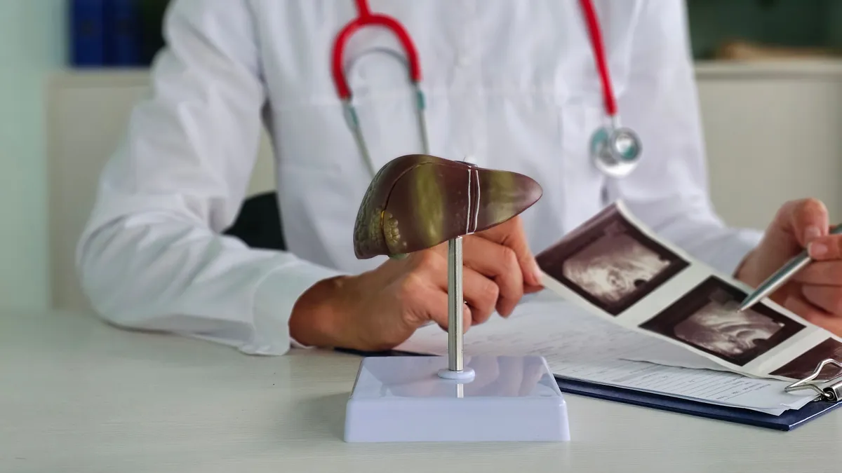 Orvos asztalán egy máj alakú makett, ami a májgyulladás jeleit mutatja.