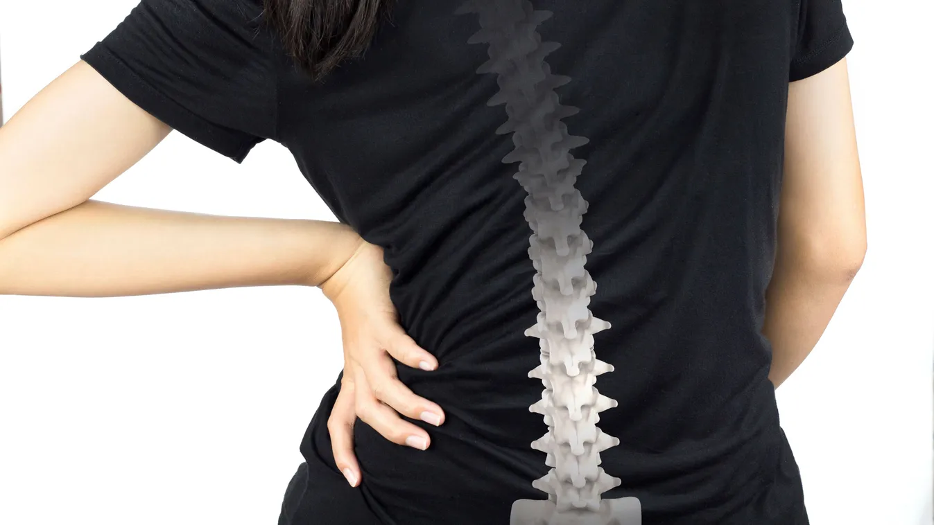 Fáj a derekad, gyorsan kifáradsz? Ezt érdemes tudnod a gerincferdülésről