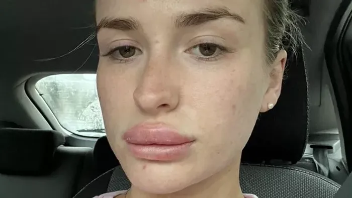 Az orvosok nem hallgattak a nőre súlyos betegség támadta meg