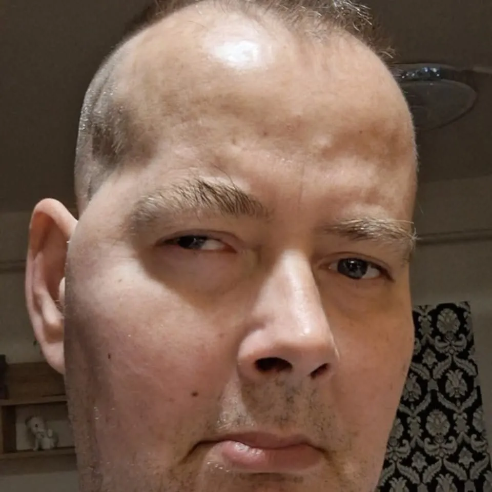 Tizenhárom éve változott meg András élete, akkor derült ki, hogy agydaganata van. 