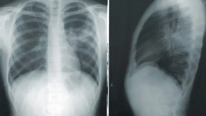 Az orvosok azt hitték, csak játssza a beteget a kisfiú